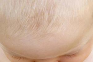 Bolehkah Bersedekah Dengan Perak Seberat Rambut Anak Dilakukan Setelah Hari Ketujuh