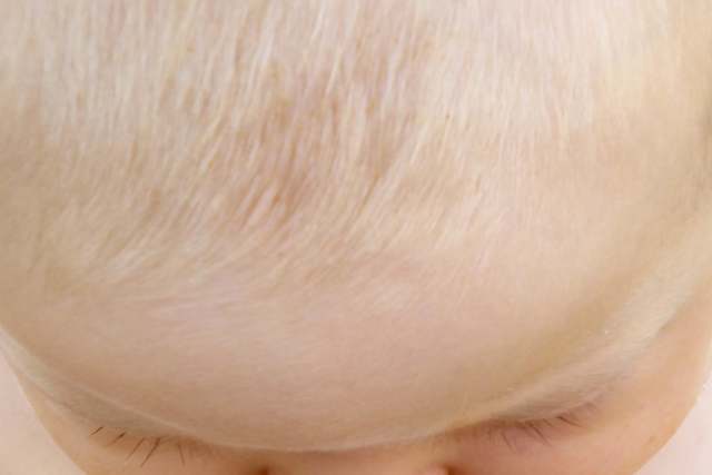 Bolehkah Bersedekah Dengan Perak Seberat Rambut Anak Dilakukan Setelah Hari Ketujuh