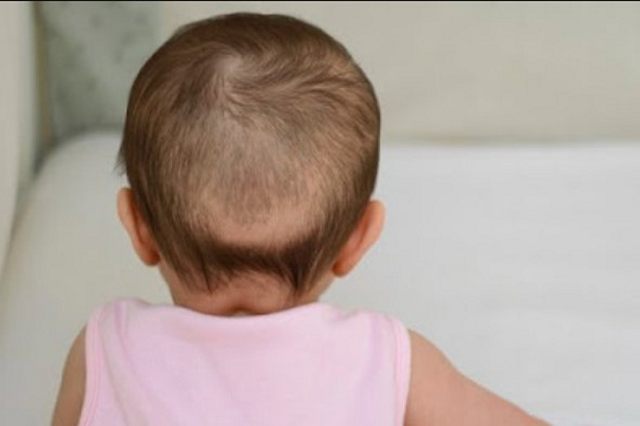 Bagimana Jika Tidak Bisa Sedekah Seberat Rambut Bayi Ketika Aqiqoh?
